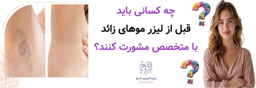 چه کسانی باید قبل از لیزر موهای زائد با متخصص مشورت کنند؟