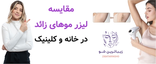 مقایسه لیزر موهای زائد در خانه و کلینیک