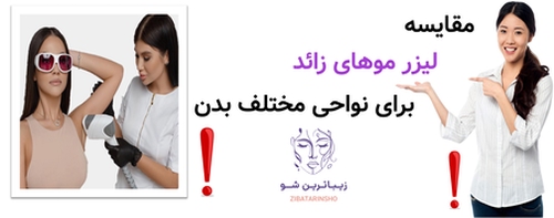 مقایسه لیزر موهای زائد برای نواحی مختلف بدن