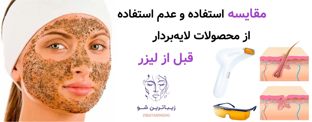 آماده سازی پوست قبل از لیزر موهای زائد، مقایسه استفاده و عدم استفاده از محصولات لایهبردار قبل از لیزر