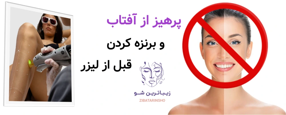 آماده سازی پوست قبل از لیزر موهای زائد، پرهیز از آفتاب و برنزه کردن قبل از لیزر
