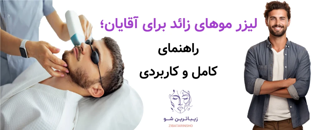 لیزر موهای زائد برای آقایان