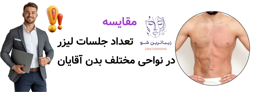 لیزر موهای زائد برای آقایان، مقایسه تعداد جلسات لیزر در نواحی مختلف بدن آقایان