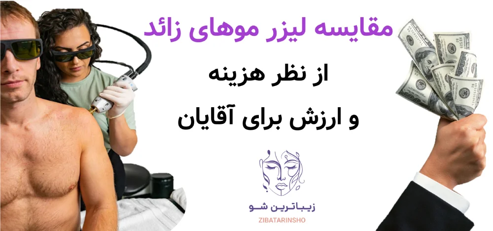 لیزر موهای زائد برای آقایان، مقایسه لیزر موهای زائد از نظر هزینه و ارزش برای آقایان