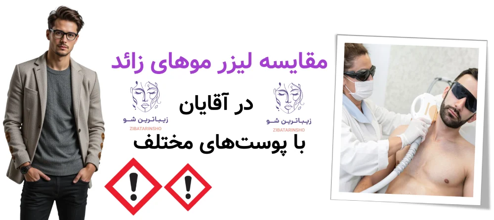 لیزر موهای زائد برای آقایان، مقایسه لیزر موهای زائد در آقایان با پوستهای مختلف