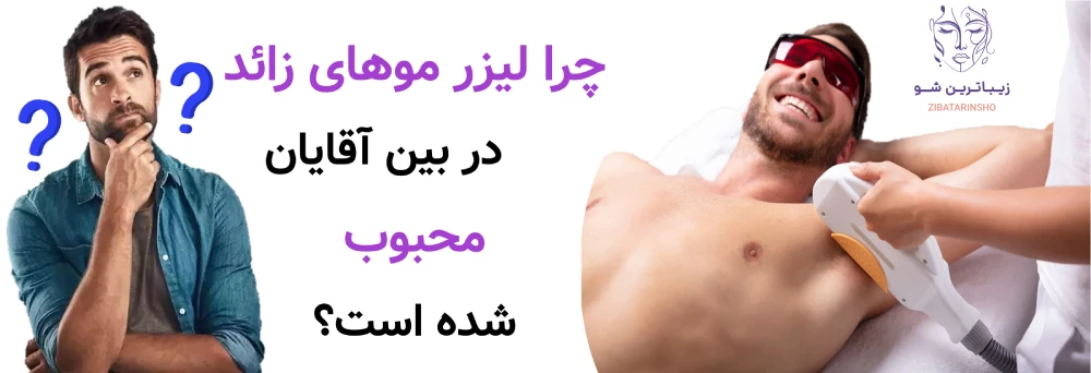 لیزر موهای زائد برای آقایان، چرا لیزر موهای زائد در بین آقایان محبوب شده است؟
