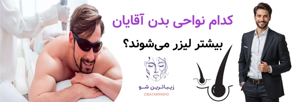 لیزر موهای زائد برای آقایان، کدام نواحی بدن آقایان بیشتر لیزر میشوند؟