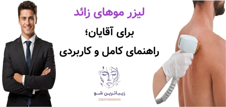 لیزر موهای زائد برای آقایان