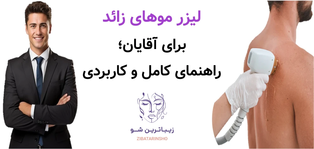لیزر موهای زائد برای آقایان