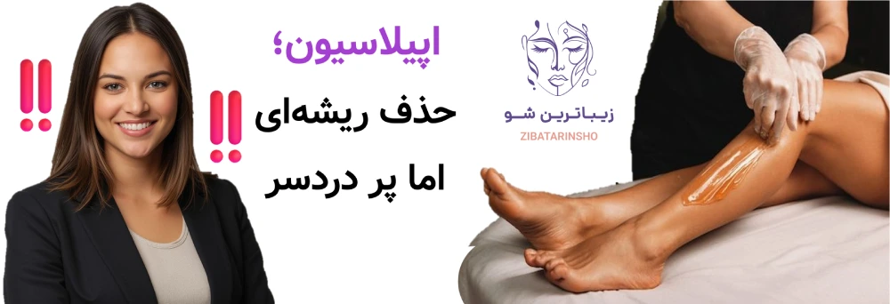 لیزر موهای زائد، یا شیو، وکس و اپیلاسیون، اپیلاسیون؛ حذف ریشهای اما پر دردسر