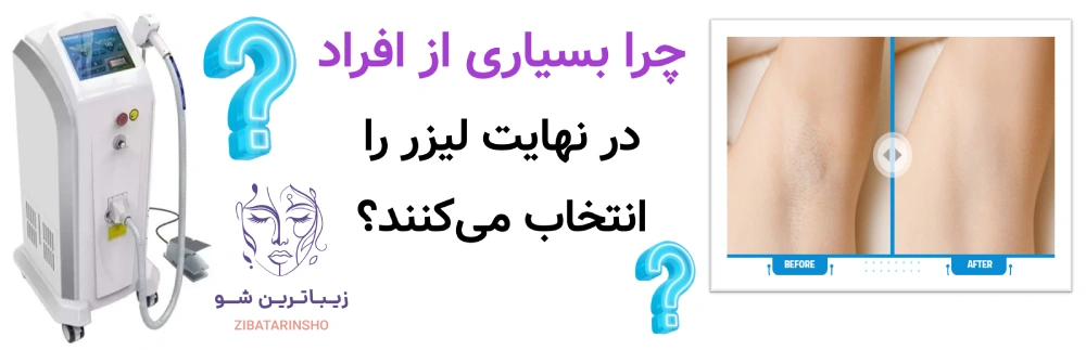 لیزر موهای زائد، یا شیو، وکس و اپیلاسیون، چرا بسیاری از افراد در نهایت لیزر را انتخاب میکنند؟