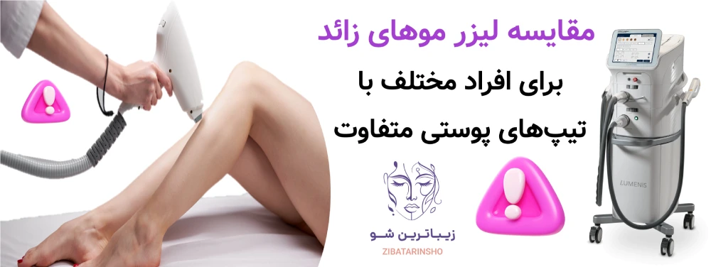 مزایا و معایب لیزر موهای زائد ، مقایسه لیزر موهای زائد برای افراد مختلف با تیپهای پوستی متفاوت