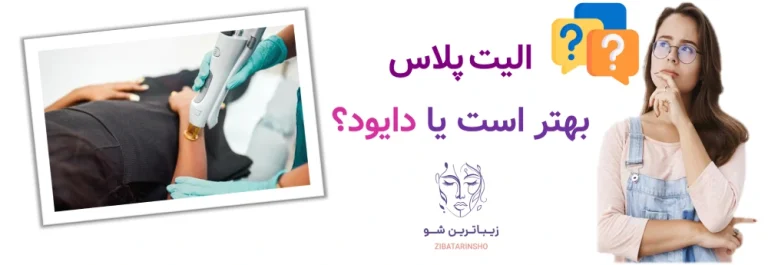 الیت پلاس بهتر است یا دایود؟
