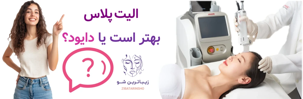 الیت پلاس بهتر است یا دایود؟
