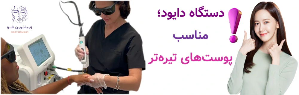 بهترین دستگاه لیزر موهای زائد در سال 2026 کدام است؟دستگاه دایود؛ مناسب پوست‌های تیره‌تر