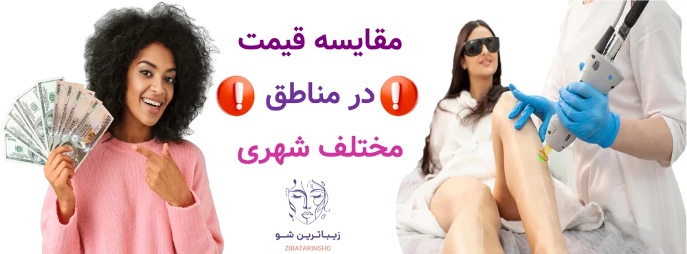 قیمت لیزر موهای زائد با الیت پلاس چقدر است؟ مقایسه قیمت در مناطق مختلف شهری