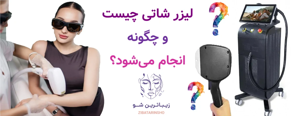 لیزر شاتی بهتر است یا رولی؟ لیزر شاتی چیست و چگونه انجام میشود؟