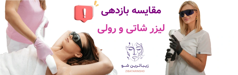 لیزر شاتی بهتر است یا رولی؟ مقایسه بازدهی لیزر شاتی و رولی