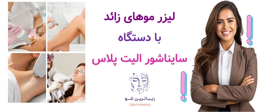 لیزر موهای زائد با دستگاه سایناشور الیت پلاس.
