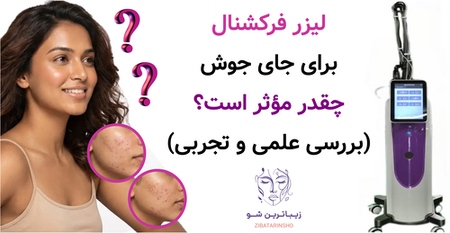 لیزر فرکشنال برای جای جوش چقدر مؤثر است؟ (بررسی علمی و تجربی)