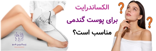 الکساندرایت برای پوست گندمی مناسب است؟