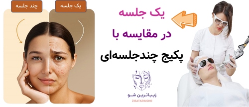 یک جلسه در مقایسه با پکیج چندجلسهای