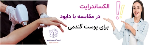 الکساندرایت در مقایسه با دایود برای پوست گندمی