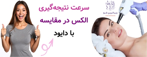 سرعت نتیجهگیری الکس در مقایسه با دایود