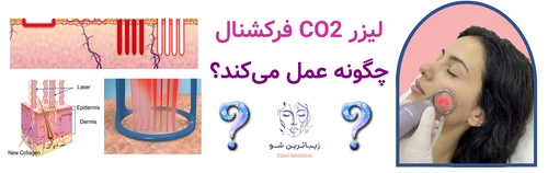 لیزر CO2 فرکشنال چگونه عمل میکند؟