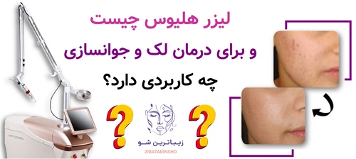لیزر هلیوس چیست و برای درمان لک و جوانسازی چه کاربردی دارد؟