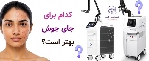 کدام برای جای جوش بهتر است؟