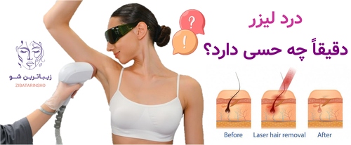 درد لیزر دقیقاً چه حسی دارد؟
