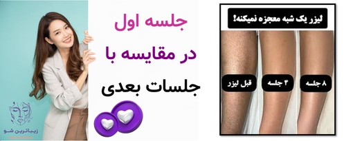 جلسه اول در مقایسه با جلسات بعدی