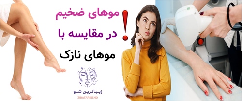 موهای ضخیم در مقایسه با موهای نازک