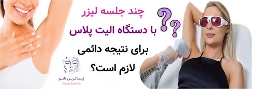 چند جلسه لیزر با دستگاه الیت پلاس برای نتیجه دائمی لازم است؟