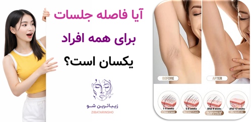آیا فاصله جلسات برای همه افراد یکسان است؟