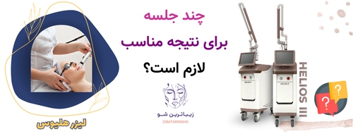 چند جلسه برای نتیجه مناسب لازم است؟