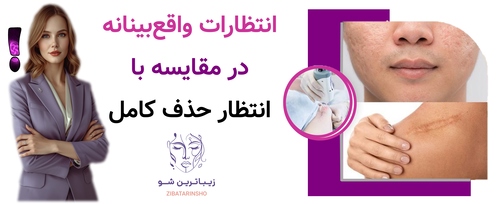 انتظارات واقعبینانه در مقایسه با انتظار حذف کامل