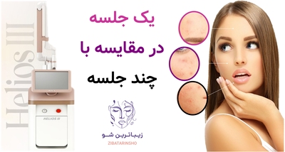 یک جلسه در مقایسه با چند جلسه
