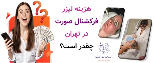 هزینه لیزر فرکشنال صورت در تهران چقدر است؟
