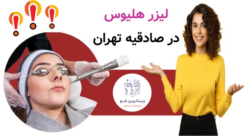لیزر هلیوس در صادقیه تهران