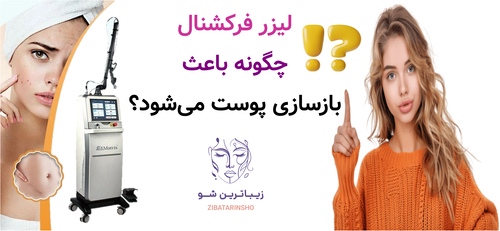 لیزر فرکشنال چگونه باعث بازسازی پوست میشود؟