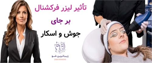 تأثیر لیزر فرکشنال بر جای جوش و اسکار