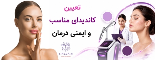 تعیین کاندیدای مناسب و ایمنی درمان
