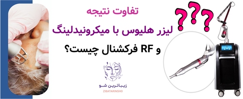 تفاوت نتیجه لیزر هلیوس با میکرونیدلینگ و RF فرکشنال چیست؟