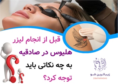 قبل از انجام لیزر هلیوس در صادقیه به چه نکاتی باید توجه کرد؟