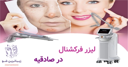 لیزر فرکشنال در صادقیه