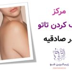 مرکز پاک کردن تاتو در صادقیه