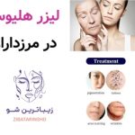 لیزر هلیوس در مرزداران