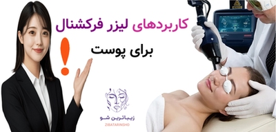 کاربردهای لیزر فرکشنال برای پوست